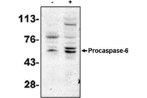 Western Blotting (WB) image for anti-Caspase 6, Apoptosis-Related Cysteine Peptidase (CASP6) antibody (ABIN264405) (Caspase 6 anticorps)