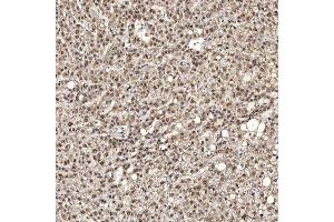 IHC analysis of U1A/SNRPA using anti-U1A/SNRPA antibody (ABIN7600891). (SNRPA1 anticorps  (AA 25-218))