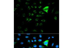 Immunofluorescence analysis of MCF-7 cells using CDKN1A Polyclonal Antibody (p21 anticorps)