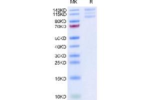Integrin alpha V, Integrin beta 6 (ITGAV/ITGB6) (AA 31-992) protein (His-Avi Tag,Biotin)