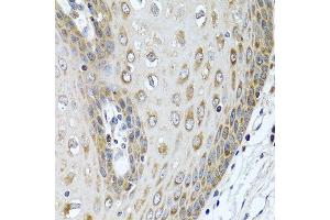 Immunohistochemistry of paraffin-embedded human esophagus using LRG1 antibody at dilution of 1:100 (40x lens). (LRG1 anticorps)