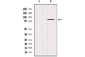 Western blot analysis of extracts from Mouse lung, using PKC zeta Antibody.
