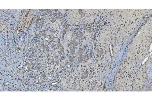IHC analysis of GRX2/GLRX2 using anti-GRX2/GLRX2 antibody (ABIN7599022). (Glutaredoxin 2 anticorps  (AA 1-164))