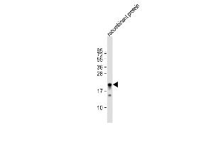 Anti-MLL2 Antibody  at 1:80000 dilution + recombinant protein whole cell lysate Lysates/proteins at 20 μg per lane. (MLL2 anticorps  (C-Term))