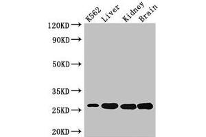 Western Blot Positive WB detected in: K562 whole cell lysate, Mouse liver tissue, Mouse kidney tissue, Mouse brain tissue All lanes: QDPR antibody at 3 μg/mL Secondary Goat polyclonal to rabbit IgG at 1/50000 dilution Predicted band size: 26, 23 kDa Observed band size: 26 kDa (QDPR anticorps  (AA 2-244))