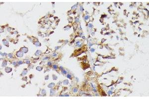 Immunohistochemistry of paraffin-embedded Mouse testis using GALC Polyclonal Antibody at dilution of 1:100 (40x lens).