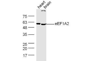 anti-eEF1A1,2 (AA 1-100) antibody