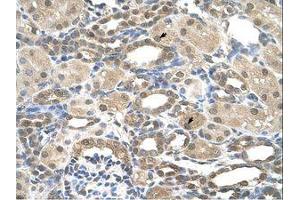 Image no. 1 for anti-Presenilin 2 (Alzheimer Disease 4) (PSEN2) (AA 101-150) antibody (ABIN6736670)