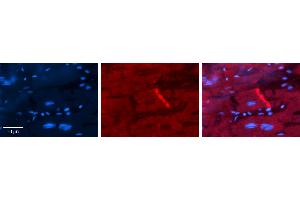 Rabbit Anti-CYBA Antibody   Formalin Fixed Paraffin Embedded Tissue: Human heart Tissue Observed Staining: Plasma membrane in intercalated disk Primary Antibody Concentration: 1:100 Other Working Concentrations: N/A Secondary Antibody: Donkey anti-Rabbit-Cy3 Secondary Antibody Concentration: 1:200 Magnification: 20X Exposure Time: 0.