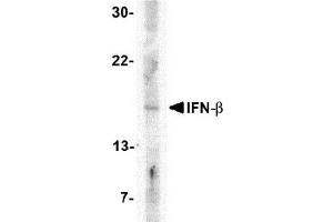 Western blot analysis of IFN-b in A-20 cell lysate with AP30401PU-N IFN-b antibody at 5 μg/ml.