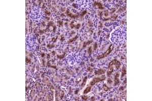 IHC testing of FFPE rat kidney tissue with PDGFRB antibody at 2 ug/ml. (PDGFRB anticorps  (AA 911-992))