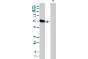Western Blot analysis of GART expression in transfected 293T cell line by GART monoclonal antibody (M01), clone 4D6-1D5. (GART anticorps  (AA 1-433))