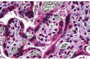 Human Placenta: Formalin-Fixed, Paraffin-Embedded (FFPE) (MAP2K3 anticorps  (AA 1-100))