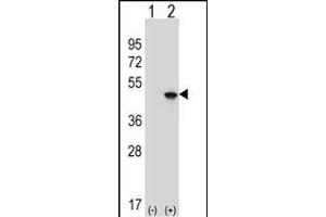 Western blot analysis of EIF4A2 (arrow) using rabbit polyclonal EIF4A2 Antibody (C-term) (ABIN653137 and ABIN2842713). (EIF4A2 anticorps  (C-Term))