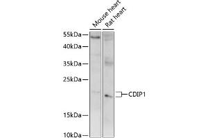 Western blot analysis of extracts of various cell lines, using CDIP1 antibody (ABIN7268288) at 1:1000 dilution.