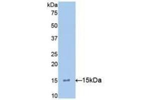 Detection of Recombinant IL15, Mouse using Polyclonal Antibody to Interleukin 15 (IL15) (IL-15 anticorps  (AA 49-162))
