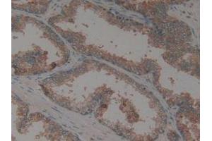 IHC-P analysis of Human Prostate Gland Tissue, with DAB staining. (CX3CL1 anticorps  (AA 25-332))