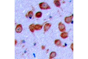 Immunohistochemical analysis of EPHA6 staining in human brain formalin fixed paraffin embedded tissue section.