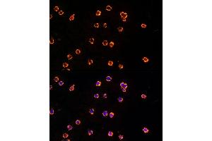Immunofluorescence analysis of THP-1 cells using TLR7 Rabbit pAb (ABIN3021246, ABIN3021247, ABIN3021248 and ABIN6214083) at dilution of 1:25 (40x lens).