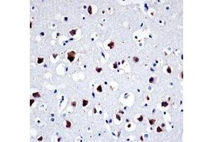 Src antibody immunohistochemistry analysis in formalin fixed and paraffin embedded human brain tissue