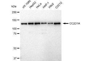 Western blotting analysis using CC2D1A antibody (ABIN7798112). (Recombinant CC2D1A anticorps)