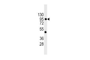 Western blot analysis of CDH1 Antibody in 293 cell line lysates (35ug/lane)