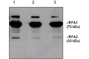 Western Blotting (WB) image for anti-Replication Protein A1, 70kDa (RPA1) antibody (ABIN190714) (RPA1 anticorps)