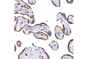 IHC analysis of RAB7/RAB7A using anti-RAB7/RAB7A antibody (ABIN7600597). (RAB7A anticorps  (AA 21-177))