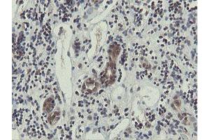 Image no. 5 for anti-OTU Domain, Ubiquitin Aldehyde Binding 1 (OTUB1) antibody (ABIN1499930)