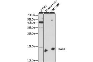 Western blot analysis of extracts of various cell lines, using RABIF antibody (ABIN7269786) at 1:1000 dilution. (RABIF anticorps  (AA 1-123))