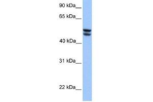 WB Suggested Anti-OXCT1 Antibody Titration:  0. (OXCT1 anticorps  (Middle Region))