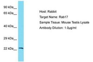 Image no. 1 for anti-RAB17, Member RAS Oncogene Family (RAB17) (AA 63-112) antibody (ABIN6750391) (RAB17 anticorps  (AA 63-112))