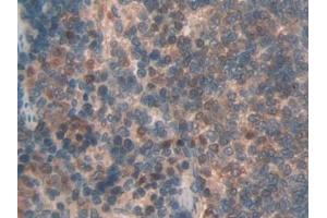 anti-Oxidized Low Density Lipoprotein (Lectin-Like) Receptor 1 (OLR1) (AA 51-314) antibody