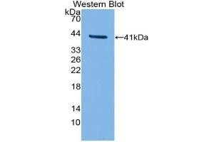 Detection of Recombinant TFR2, Human using Polyclonal Antibody to Transferrin Receptor 2 (TFR2) (Transferrin Receptor 2 anticorps  (AA 604-703))