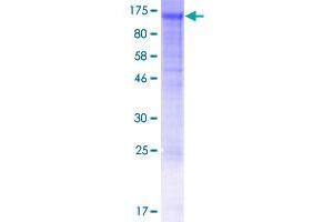 Image no. 1 for Nidogen 2 (NID2) (AA 1-969) protein (GST tag) (ABIN1312570)