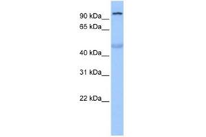 WB Suggested Anti-TULP3 Antibody Titration:  0. (TULP3 anticorps  (N-Term))