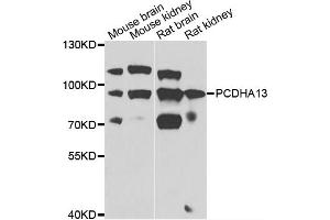 Western blot analysis of extracts of various cell lines, using PCDHA13 antibody (ABIN4904701) at 1:1000 dilution. (PCDHa13 anticorps)