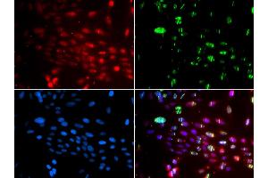 Immunofluorescence analysis of GFP-RNF168 transgenic U2OS cell using L3MBTL1 antibody. (L3MBTL1 anticorps)
