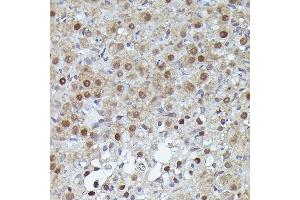 Immunohistochemistry of paraffin-embedded human esophagus using S100 Rabbit pAb (ABIN3015803, ABIN3015804, ABIN3015805, ABIN1682607 and ABIN6219148) at dilution of 1:100 (40x lens).