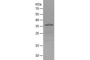 Western Blotting (WB) image for Dipeptidyl-Peptidase 3 (DPP3) (AA 593-737) protein (His-IF2DI Tag) (ABIN7122673) (DPP3 Protein (AA 593-737) (His-IF2DI Tag))