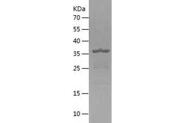 DPP3 Protein (AA 593-737) (His-IF2DI Tag)