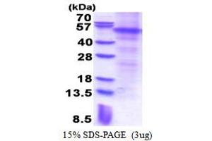 SDS-PAGE (SDS) image for Parkinson Protein 2, E3 Ubiquitin Protein Ligase (Parkin) (PARK2) (AA 1-465) protein (His tag) (ABIN5853490)