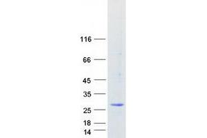 Validation with Western Blot