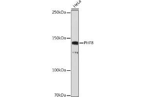 Western blot analysis of extracts of HeLa cells, using PHF8 antibody (ABIN7269263) at 1:1000 dilution. (PHF8 anticorps)
