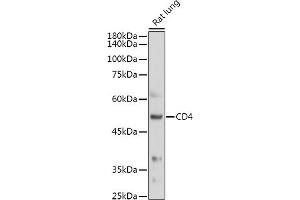 Western blot analysis of extracts of Rat lung, using CD4 antibody (ABIN6134777, ABIN6138187, ABIN6138189 and ABIN6213821) at 1:500 dilution.