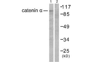 Western blot analysis of extracts from HeLa cells, using Catenin- alpha antibody. (CTNNA1 anticorps  (C-Term))