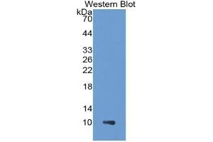 WB of Protein Standard: different control antibodies against Highly purified E. (CUL9 Kit CLIA)