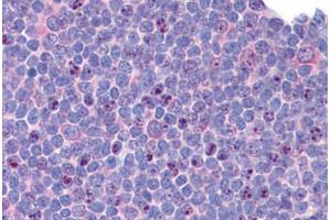 Human Tonsil: Formalin-Fixed, Paraffin-Embedded (FFPE)