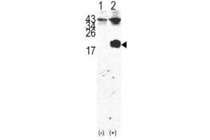 Western blot analysis of FKBP12 antibody and 293 cell lysate either nontransfected (Lane 1) or transiently transfected with the FKBP12 gene (2). (FKBP1A anticorps  (AA 43-74))