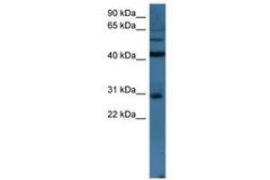 Image no. 1 for anti-T-Cell Leukemia Homeobox 2 (TLX2) (N-Term) antibody (ABIN6746163) (TLX2 anticorps  (N-Term))